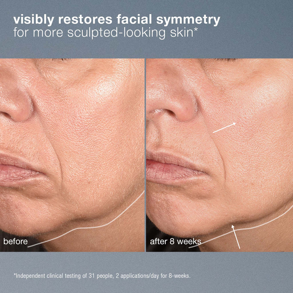 Before and after comparison of facial skin with text indicating restoration of facial symmetry.