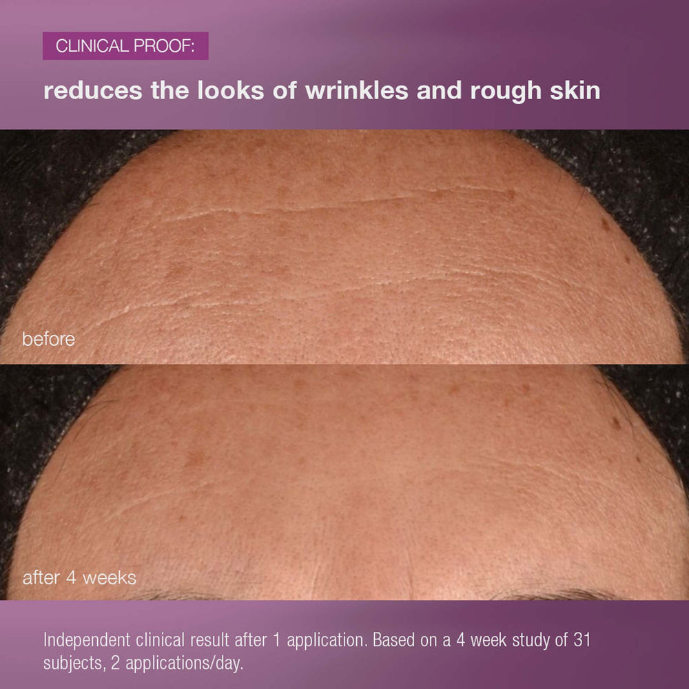 Before and after comparison of skin with text indicating reduction of wrinkles and rough skin.